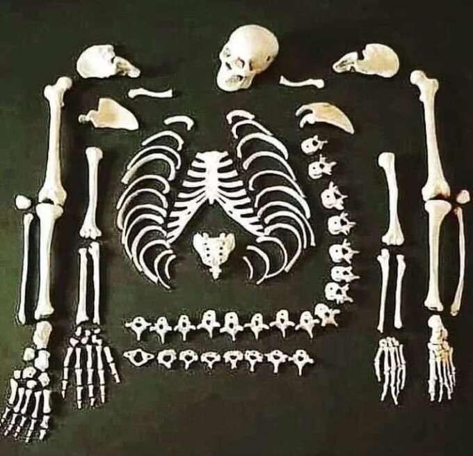The human body contains 206 bones…