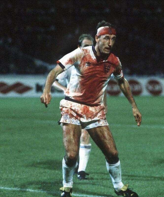 Terry #Butcher is bloodied after suffering…