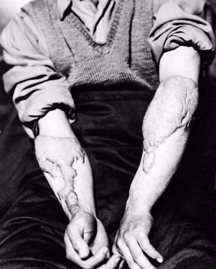 A woman shows her scars left…